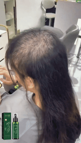 Spray Para Crecer El Pelo OUHOE – KEVSAN TIENDA VIRTUAL